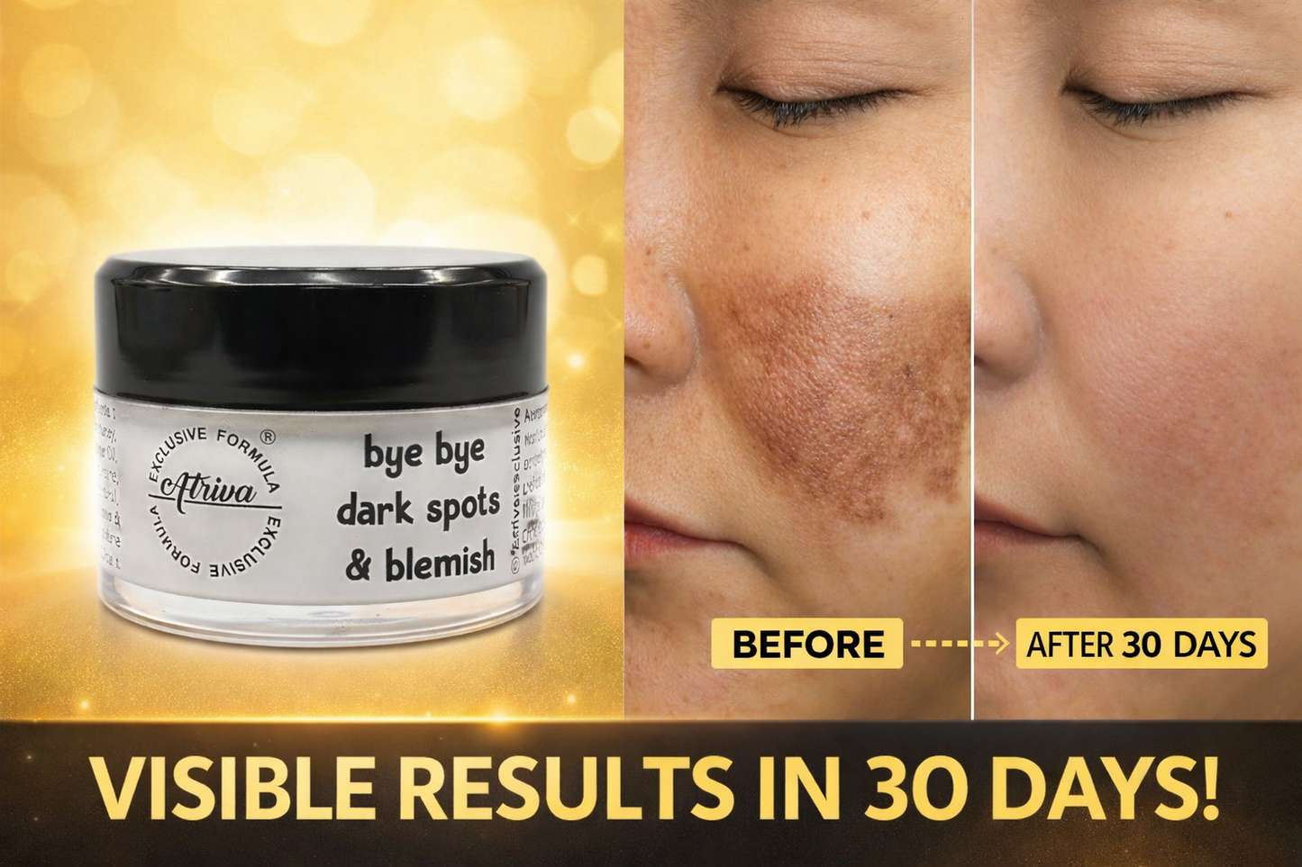 ATRIVA Bye Bye Dark Spot Night Cream